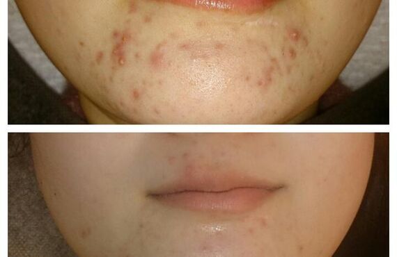 乾燥肌ケアは大宮エステサロンGLANDBEAUTYへ